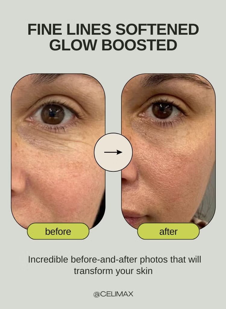 Retinal Shot Tightening Booster - ANOKHI DOKAN