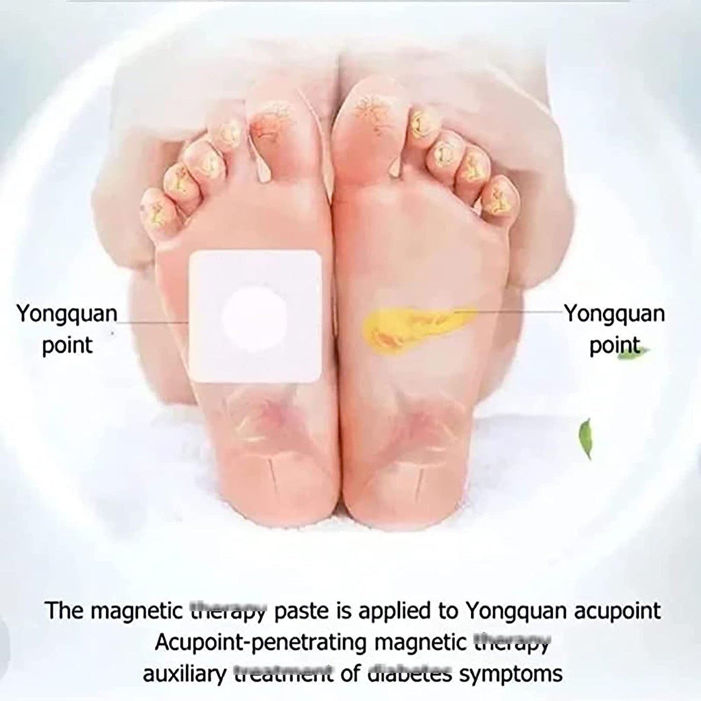 Huatangxiao Acupoint Pressure Stimulation Stickers - ANOKHI DOKAN