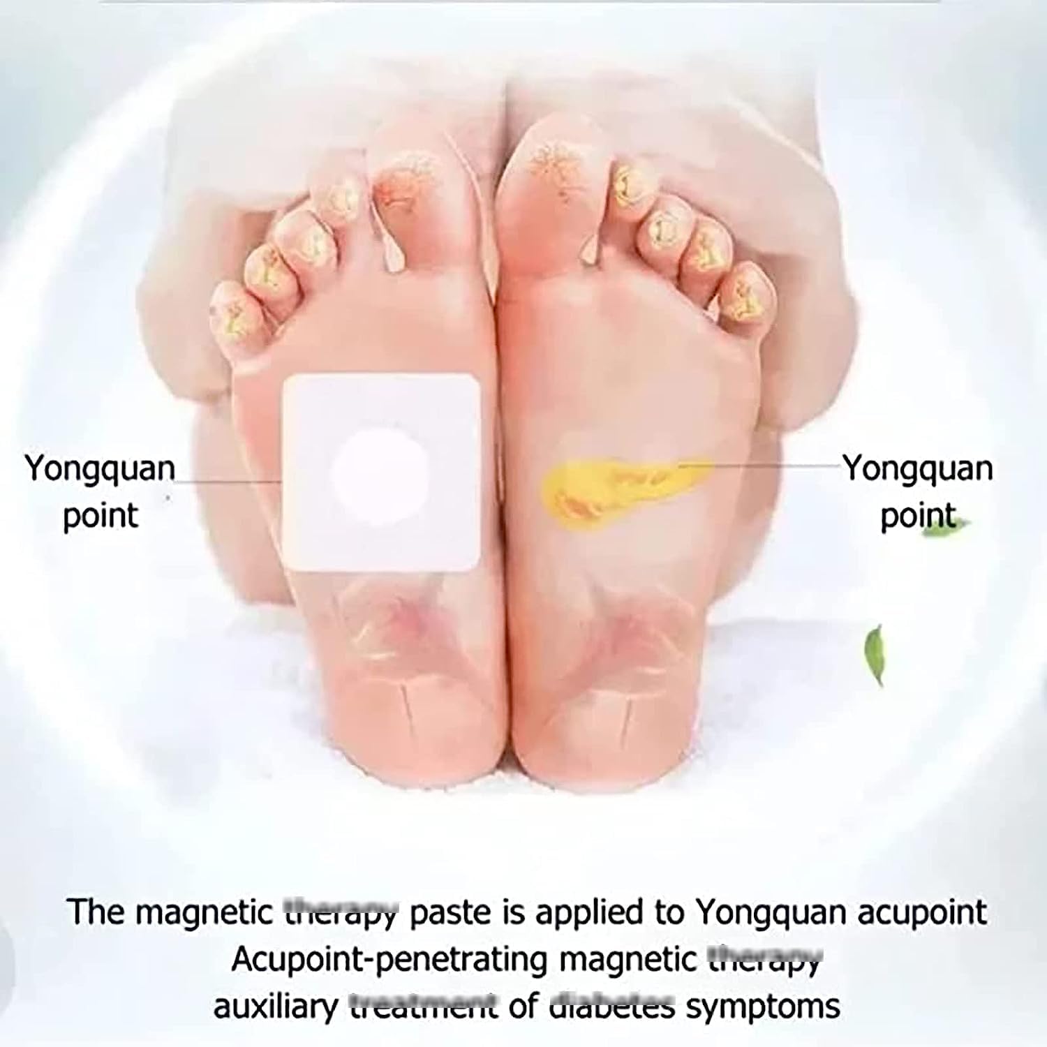 Huatangxiao Acupoint Pressure Stimulation Stickers - ANOKHI DOKAN