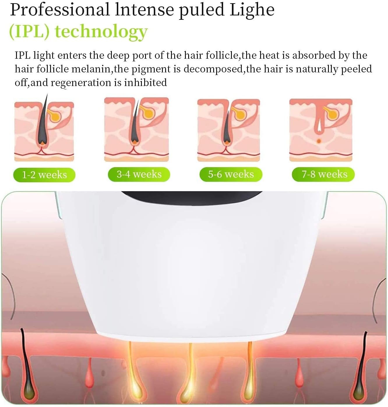 IPL Hair Removal System - ANOKHI DOKAN